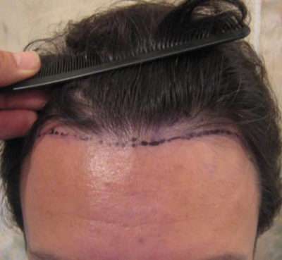 Male Patient