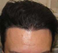 Male Patient