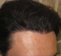 Male Patient