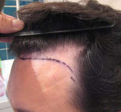 Male Patient