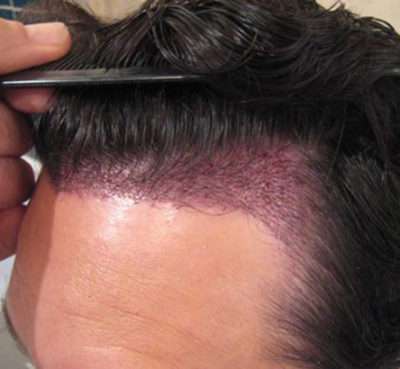 Male Patient