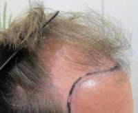 Male Patient