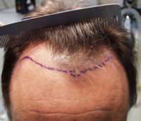 Male Patient