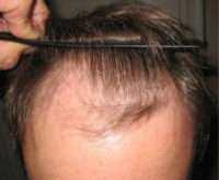 Male Patient