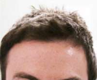 Male Patient