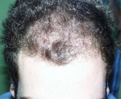 Male Patient