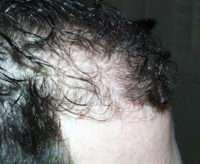 Male Patient