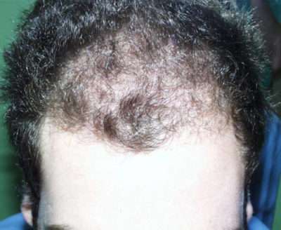 Male Patient
