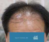 Male Patient