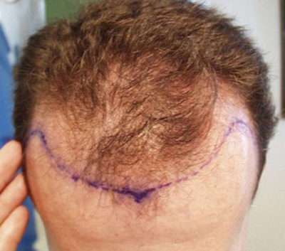 Male Patient