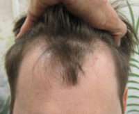 Male Patient