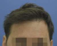 Male Patient