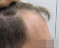 Male Patient