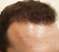 Male Patient
