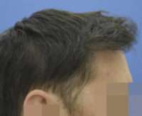Male Patient
