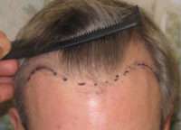 Male Patient