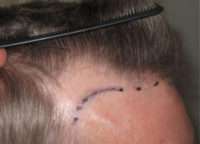 Male Patient