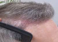 Male Patient