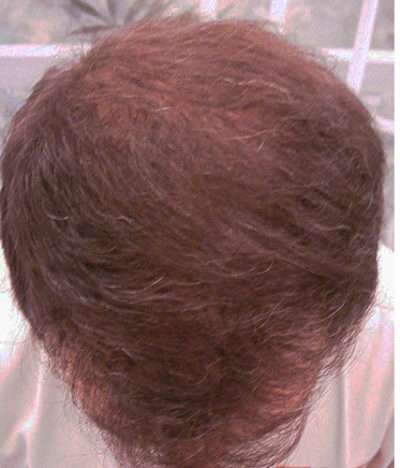 Corrective Surgery