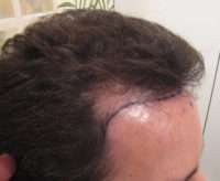 Male Patient