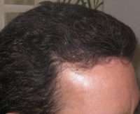 Male Patient