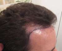 Male Patient