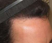Male Patient