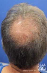 Male Patient