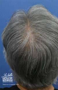 Male Patient