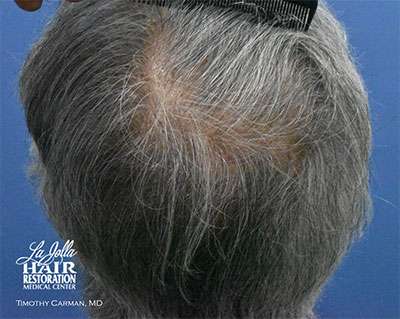Male Patient