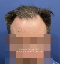 Male Patient
